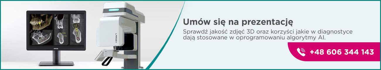 Umów się na prezentację -  Sprawdź jakość zdjęć 3D oraz korzyści jakie w diagnostyce dają stosowane w oprogramowaniu algorytmy AI.