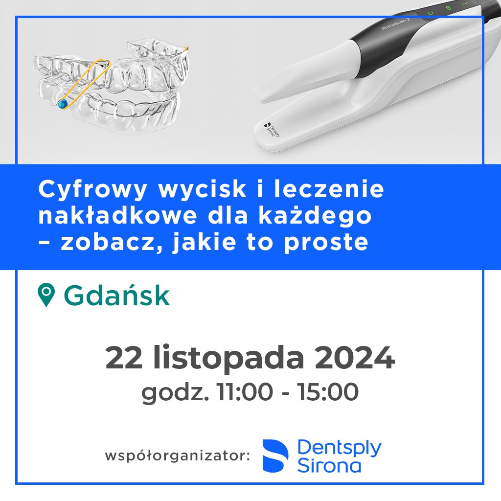 Gdańsk – Cyfrowy wycisk i leczenie nakładkowe dla każdego – zobacz, jakie to proste